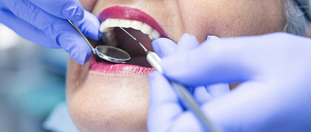 Best Emergency Treatment for Dental Infections or Abscesses in Villa Ridge, MO